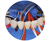 Изоляция рабочего поля на стоматологическом приеме