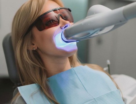 Отличие домашнего отбеливания зубов от кабинетного