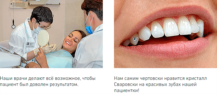 Украшения на зубы Томск Кривоносенко