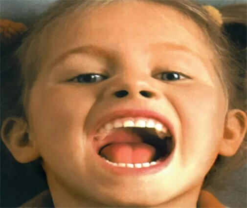 <p>Все мамы знают, что ребенок должен чистить зубы вовремя, и идут на всевозможные ухищрения, приучая его к качественной ежедневной гигиене. Однако она не становится панацеей, и вот уже мама с малышом приходят на прием к стоматологу с грустным: «Ну как же так, мы ведь регулярно и правильно чистим зубки, но кариес всё равно появляется...».</p>

<ul>
</ul>
